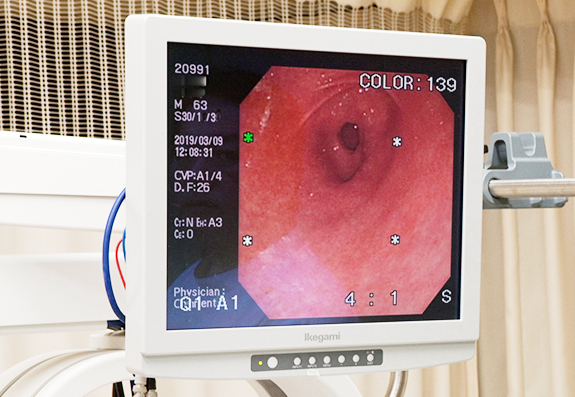 粘膜下の病変もキャッチする「NBI」を導入